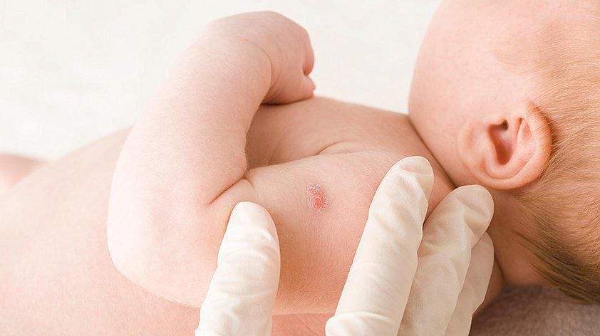 BSJ vaksinasi qanchalik muhim?