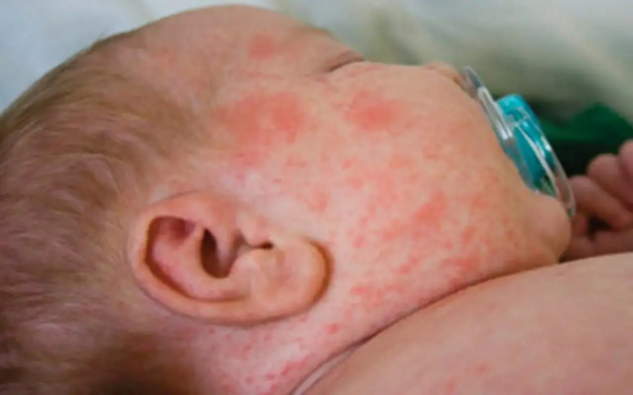 QIZAMIQDAN KEYINGI ASORATLAR