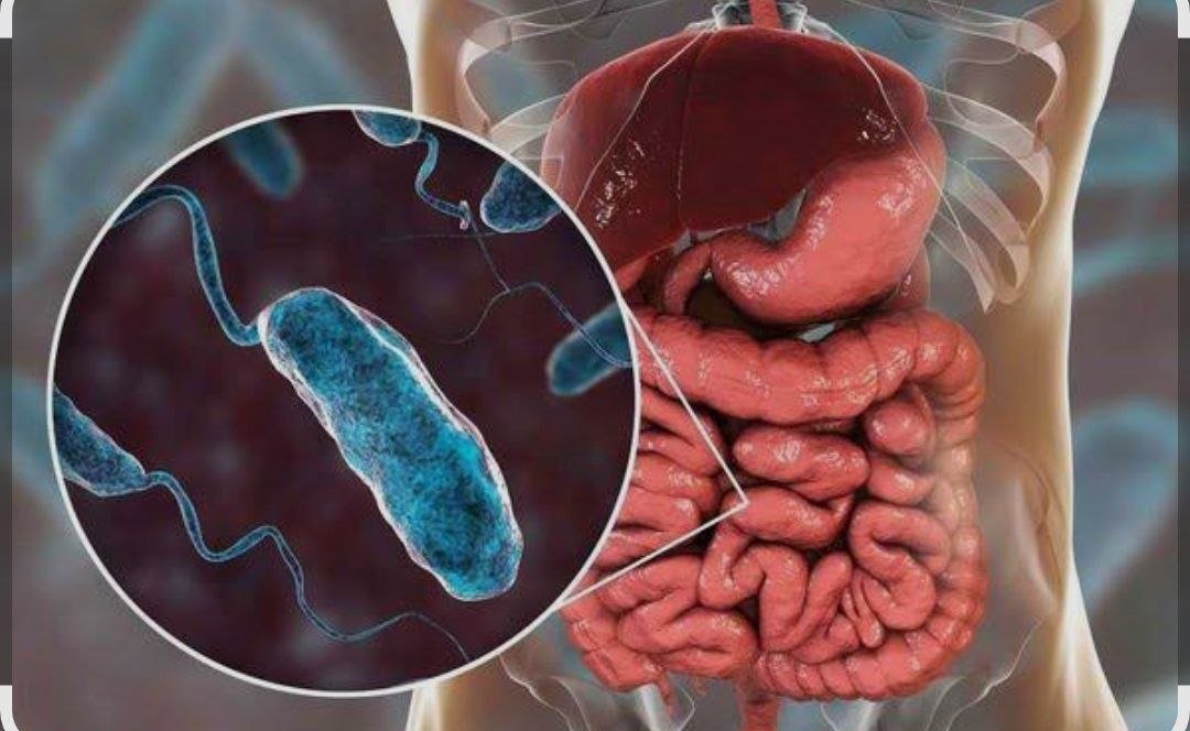 Vabo kasalligidan ogoh boʻling!