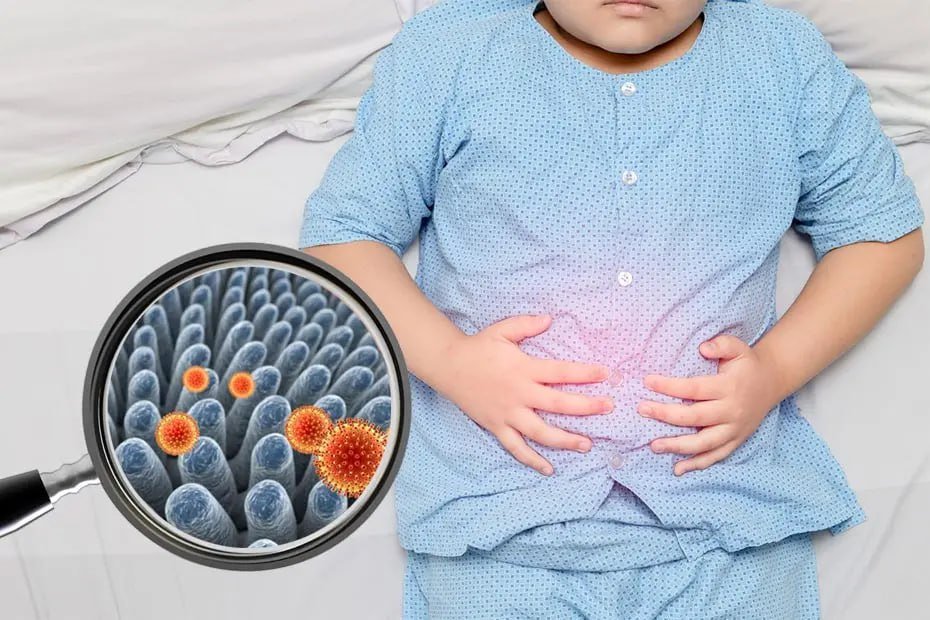 ROTAVIRUS BILAN KO‘PROQ 3 YOSHGACHA BO‘LGAN BOLALAR ZARARLANADI